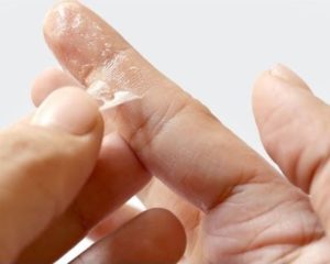 Cómo despegar dedos pegados con la gotita de pegamento